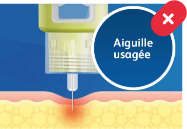 Aiguille usagée